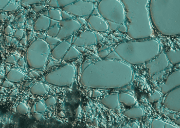 When Nutrients Become Pollution 