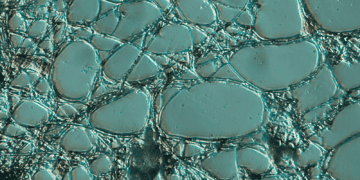 When Nutrients Become Pollution 