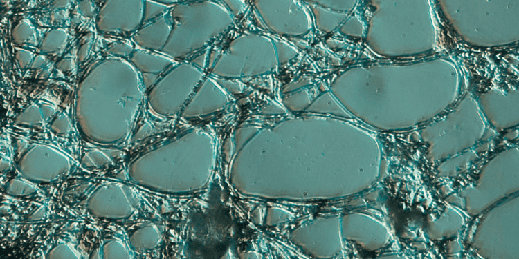 When Nutrients Become Pollution